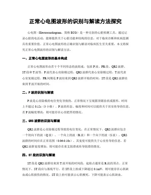 正常心电图波形的识别与解读方法探究