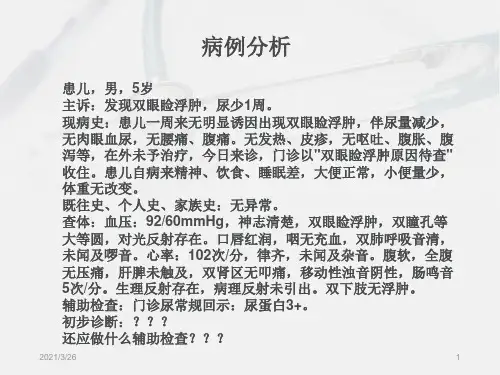 《小儿肾病综合征》PPT课件