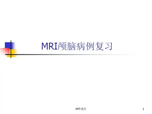 MRI颅脑典型病例  ppt课件