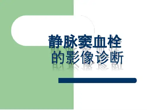 静脉窦血栓的影像诊断
