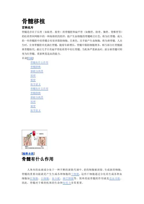 关于骨髓移植