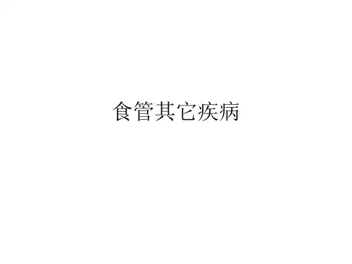 外科学PPT课件 食管疾病食管其它疾病