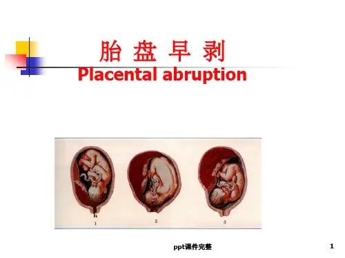 胎盘早剥_PPT课件