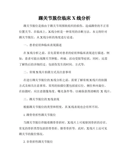 踝关节脱位临床X线分析