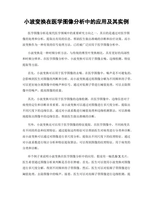 小波变换在医学图像分析中的应用及其实例