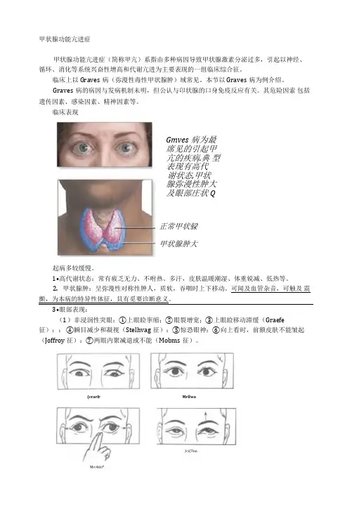 甲状腺功能亢进症等介绍、检查及病例分析