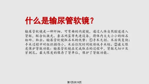 输尿管软镜健康宣教PPT课件