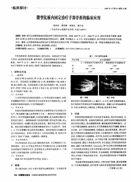 微型钛板内固定治疗手部骨折的临床应用