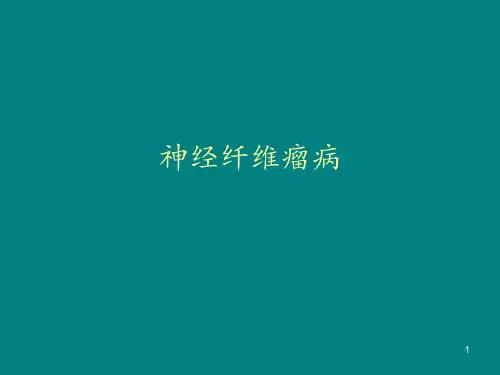 神经纤维瘤 ppt课件