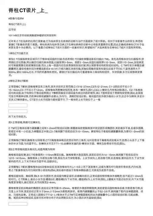 脊柱CT读片_上_