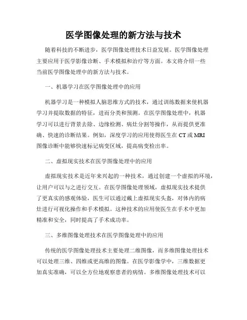 医学图像处理的新方法与技术