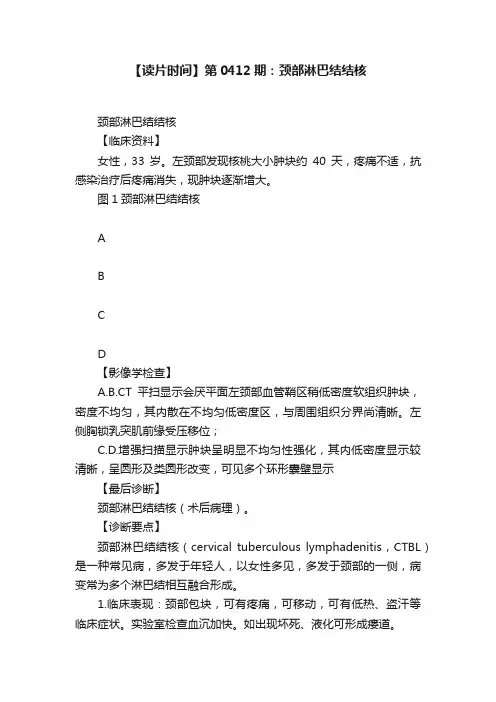 【读片时间】第0412期：颈部淋巴结结核