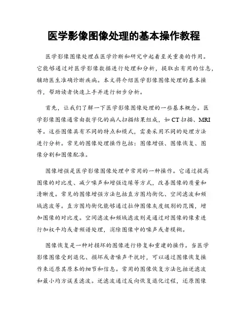 医学影像图像处理的基本操作教程