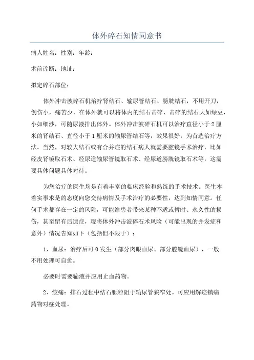 体外碎石知情同意书