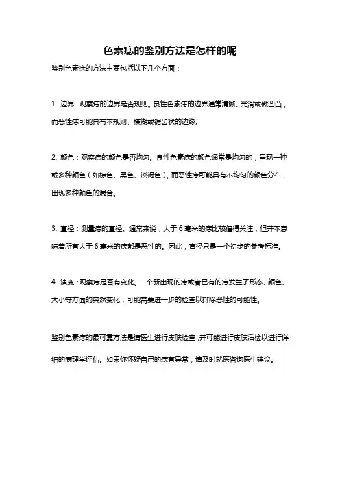 色素痣的鉴别方法是怎样的呢