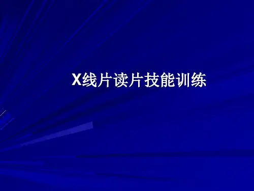 最新 X线读片技能训练