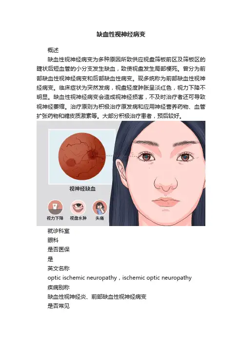 缺血性视神经病变