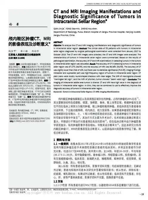 颅内鞍区肿瘤CT、MRI的影像表现及诊断意义