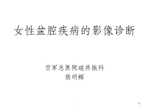 女性盆腔疾病的影像诊断
