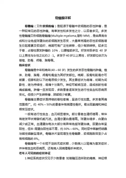 骨髓瘤详解