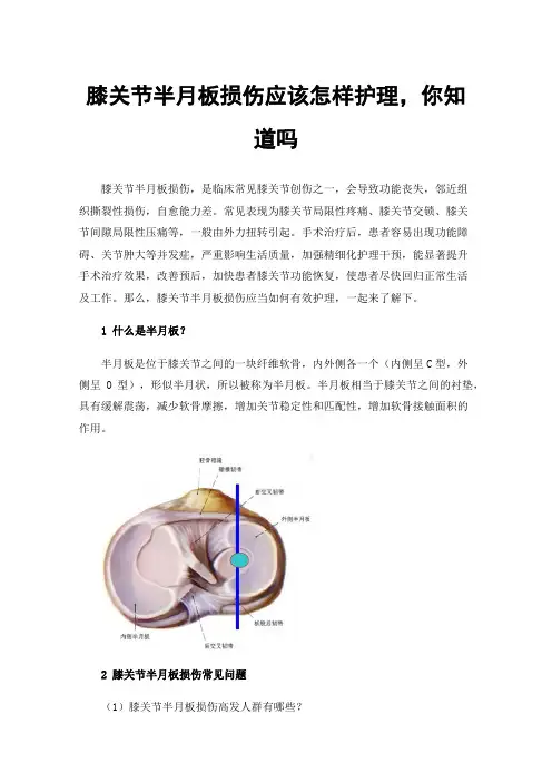 膝关节半月板损伤应该怎样护理，你知道吗