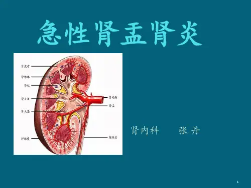 急性肾盂肾炎ppt课件