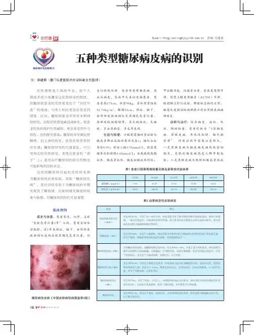 五种类型糖尿病皮病的识别
