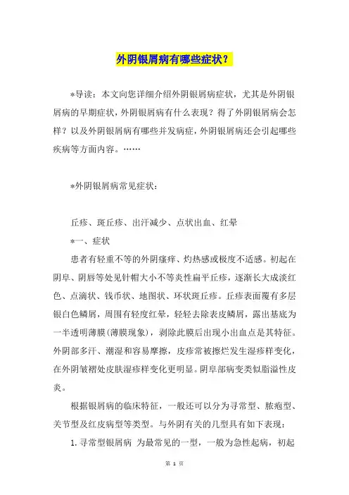 外阴银屑病有哪些症状？