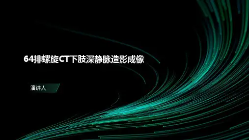 64排螺旋CT下肢深静脉造影成像
