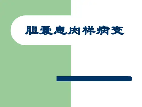 胆囊息肉样病变