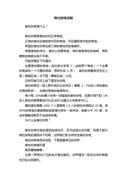 脊柱侧弯讲解
