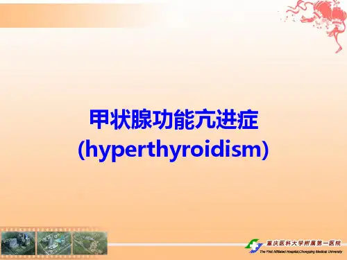 甲状腺功能亢进