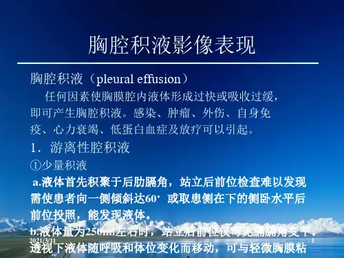 胸腔积液的影像诊断