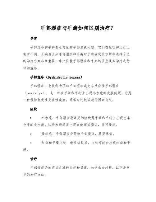 手部湿疹与手癣如何区别治疗？[1]