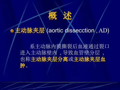 主动脉夹层PPT课件