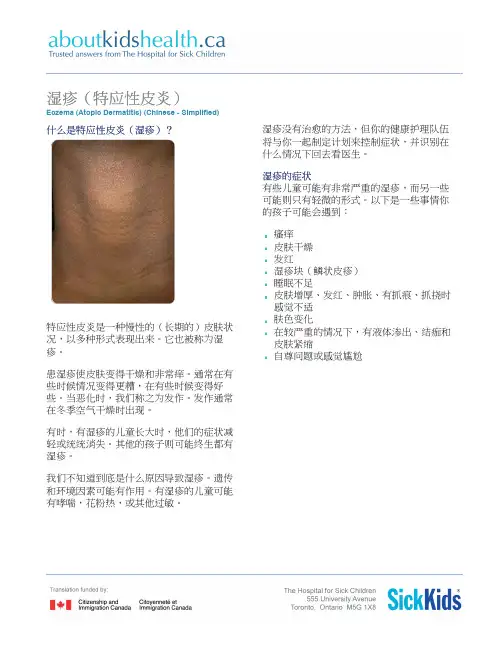 Eczema-atopic-dermatitis_湿疹_特应性皮炎