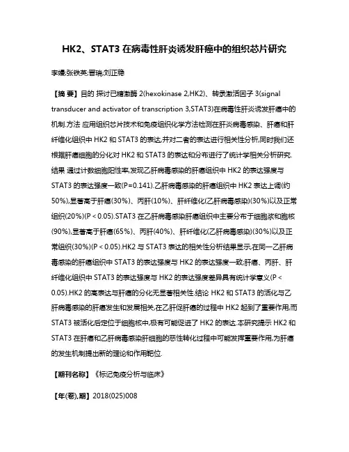 HK2、STAT3在病毒性肝炎诱发肝癌中的组织芯片研究