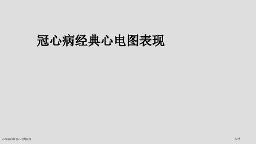 心绞痛的典型心电图表现