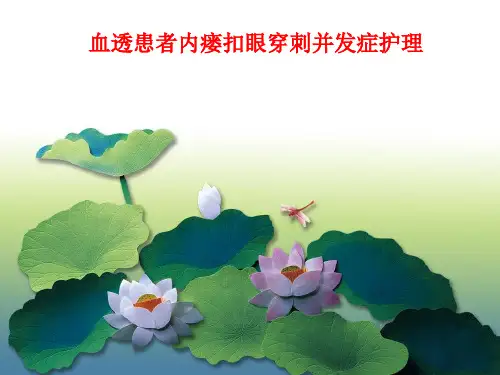 扣眼穿刺法