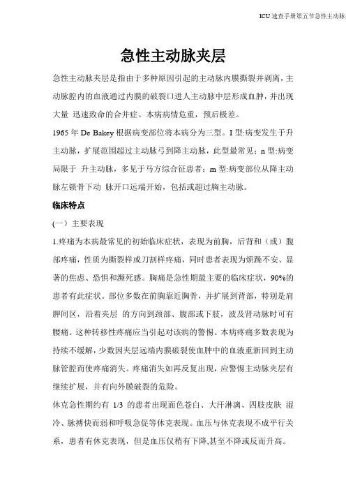 急性主动脉夹层3
