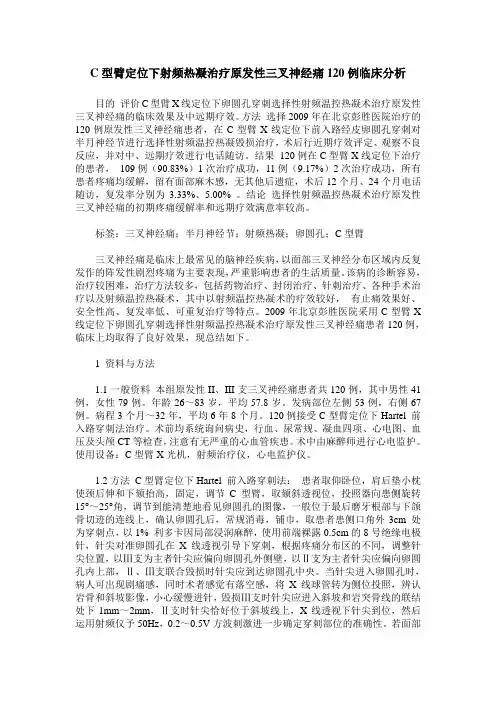 C型臂定位下射频热凝治疗原发性三叉神经痛120例临床分析
