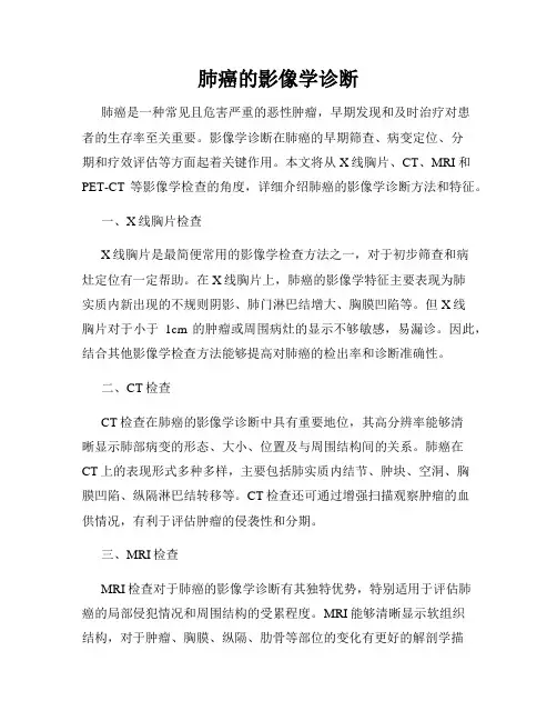 肺癌的影像学诊断