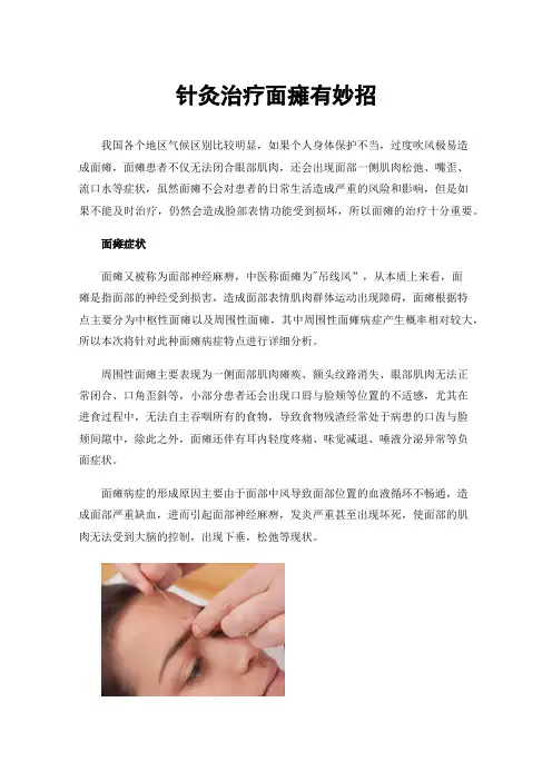 针灸治疗面瘫有妙招