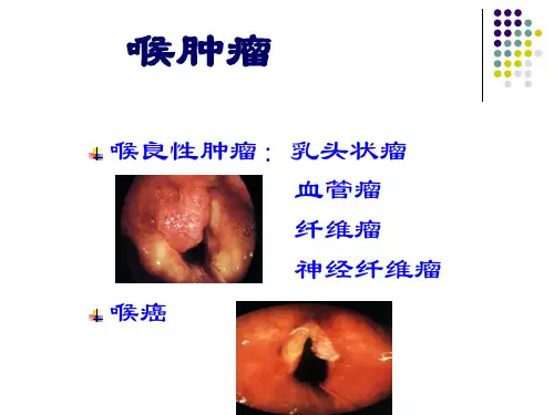 6喉癌