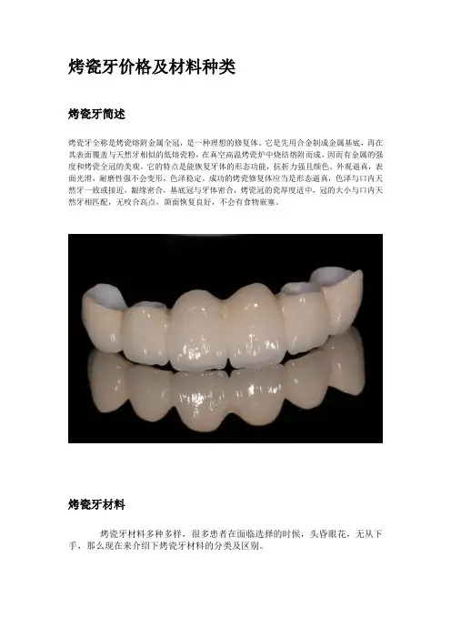 烤瓷牙材料种类选择