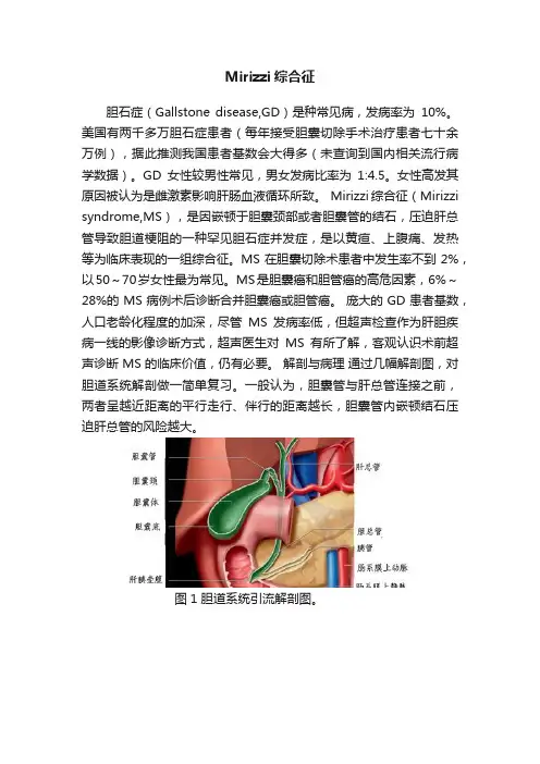 Mirizzi综合征