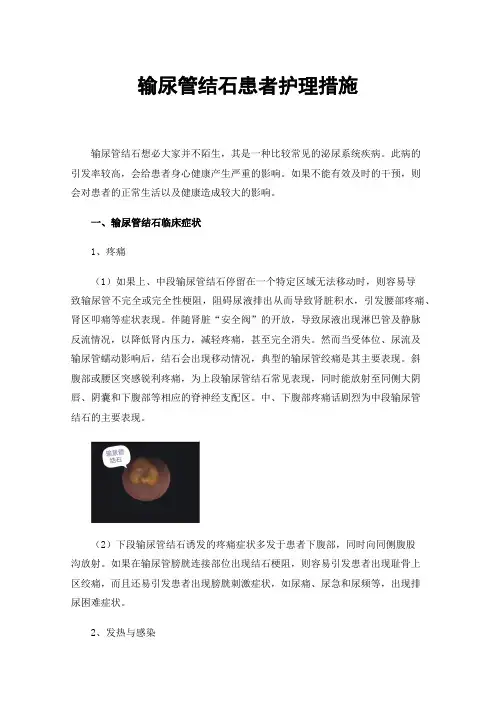 输尿管结石患者护理措施