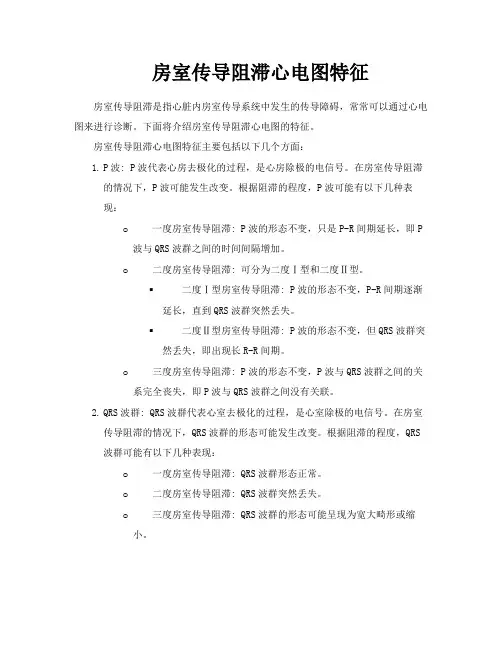 房室传导阻滞心电图特征