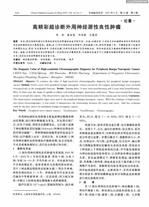 高频彩超诊断外周神经源性良性肿瘤
