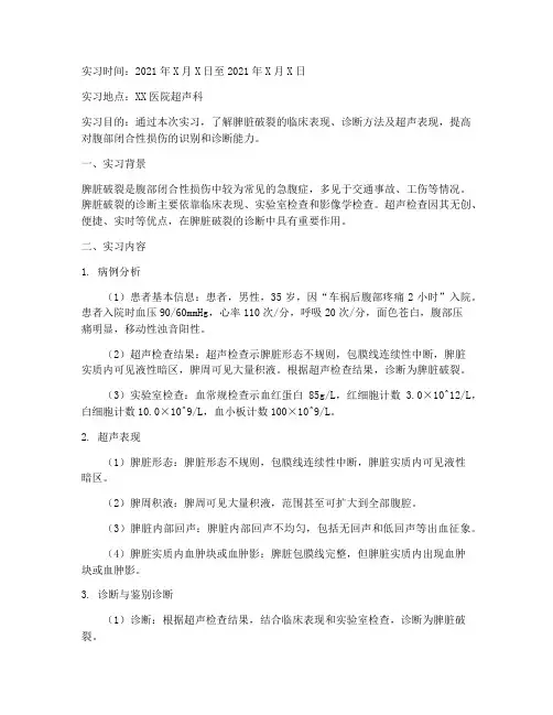 脾脏破裂超声实习报告